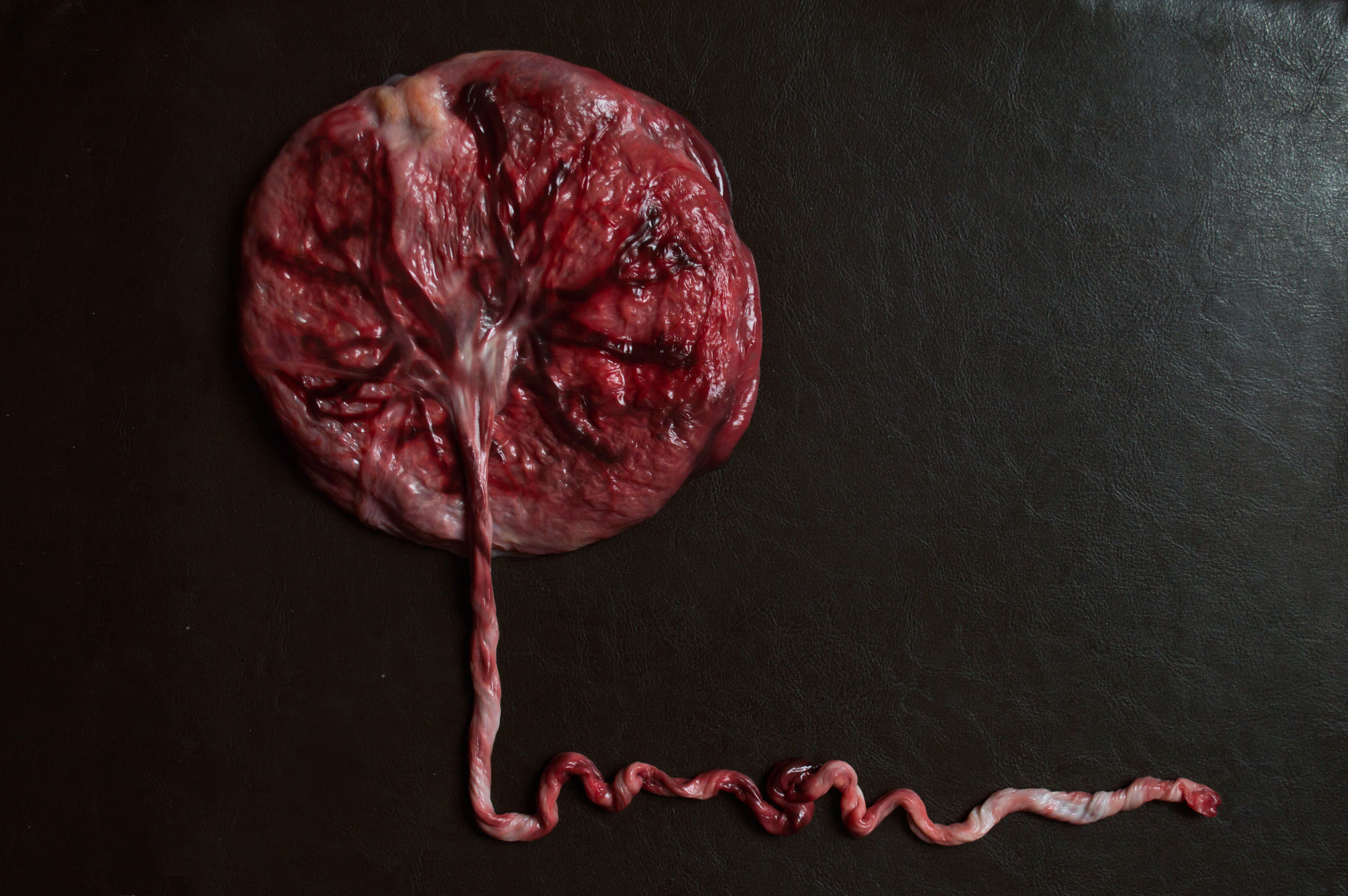 placenta