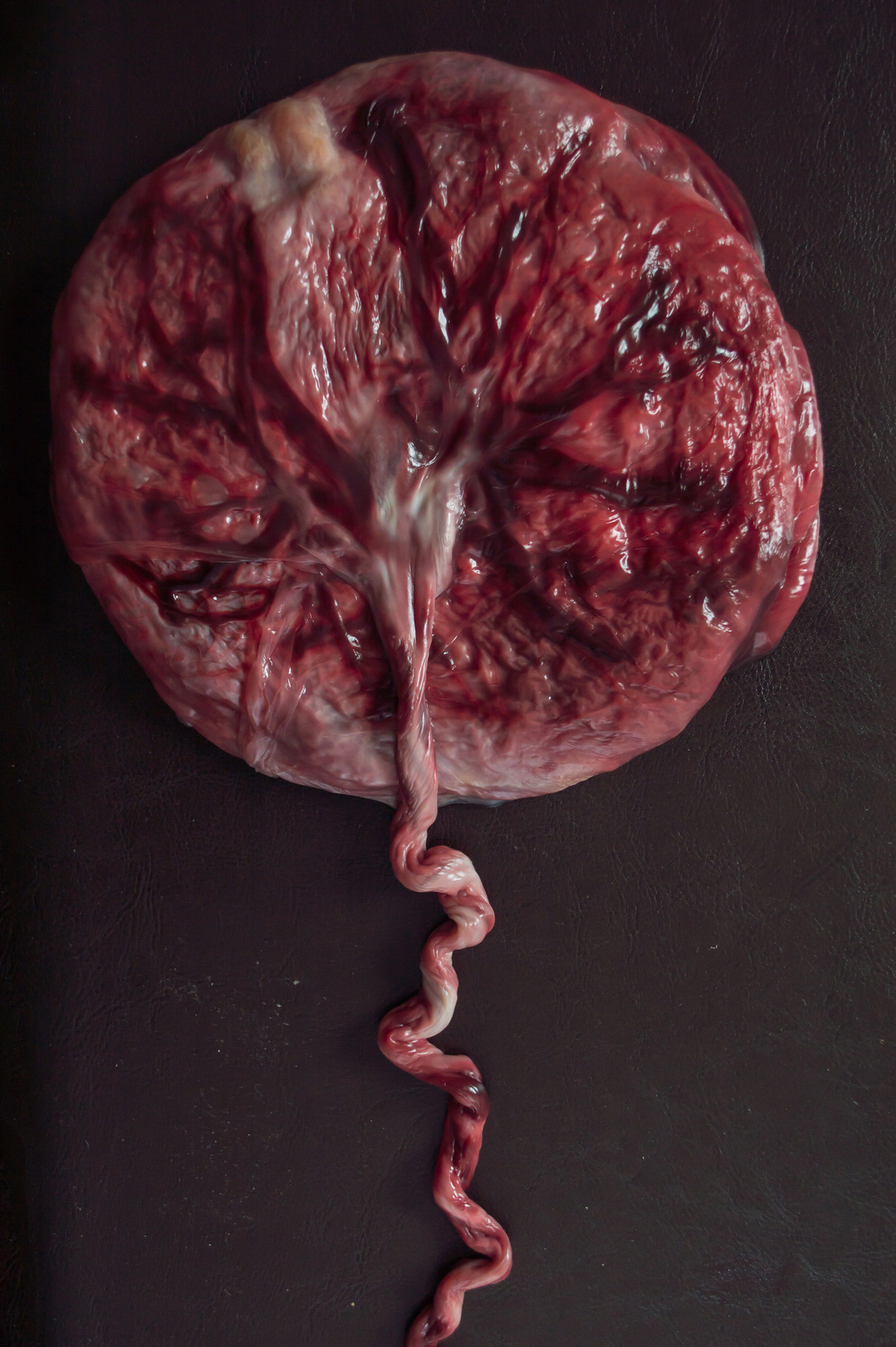 placenta